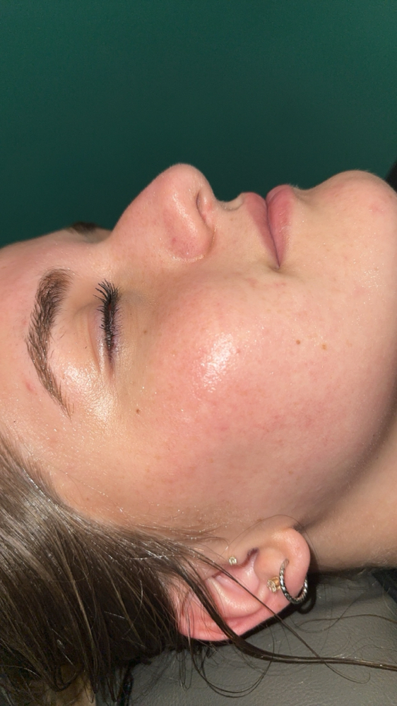 Express Facial