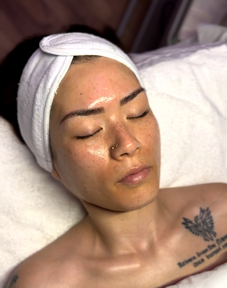 Summer Oxygen Treatment
