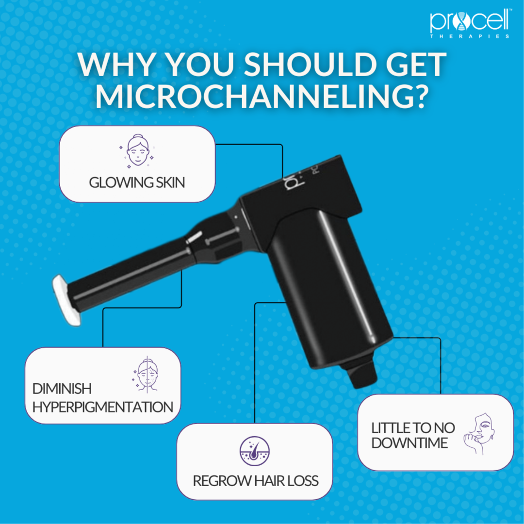 Procell Micro channeling-1 session