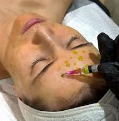 Bio-RePeel Facial