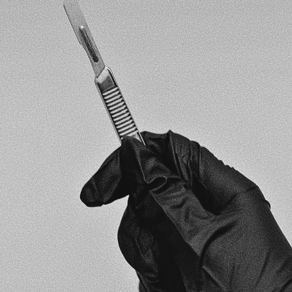 Dermaplane *add on at skinnbykenzz in Baldwinsville, NY