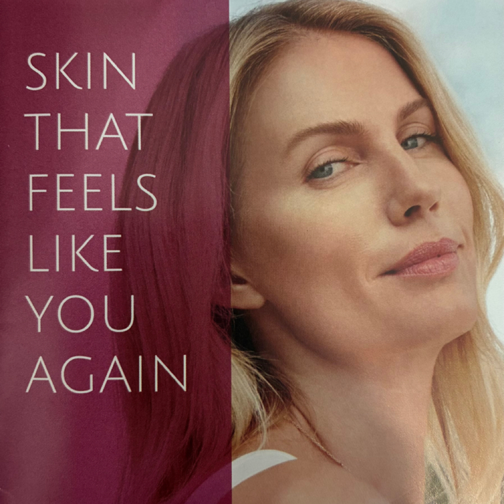 Sculptra at VitaGrace Aesthetics in Rockwall, TX