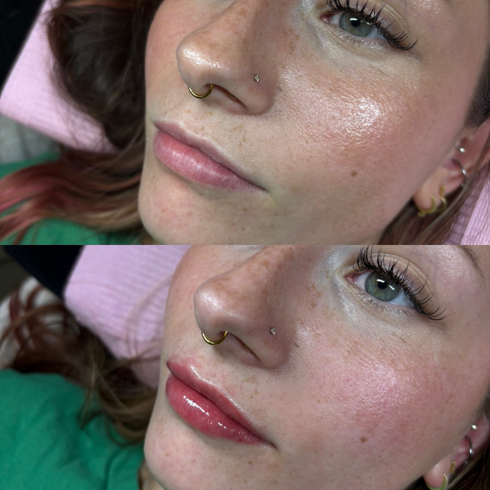 Lip Blushing