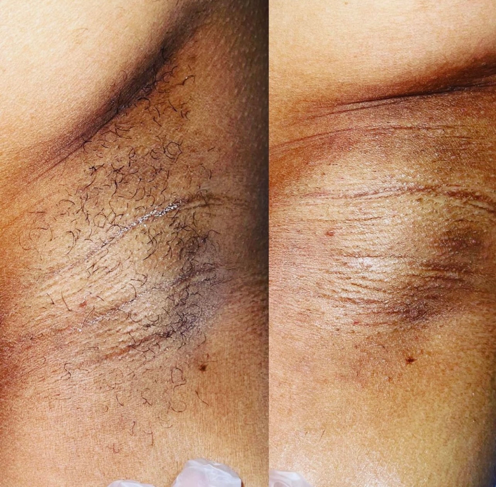 Underarm Wax