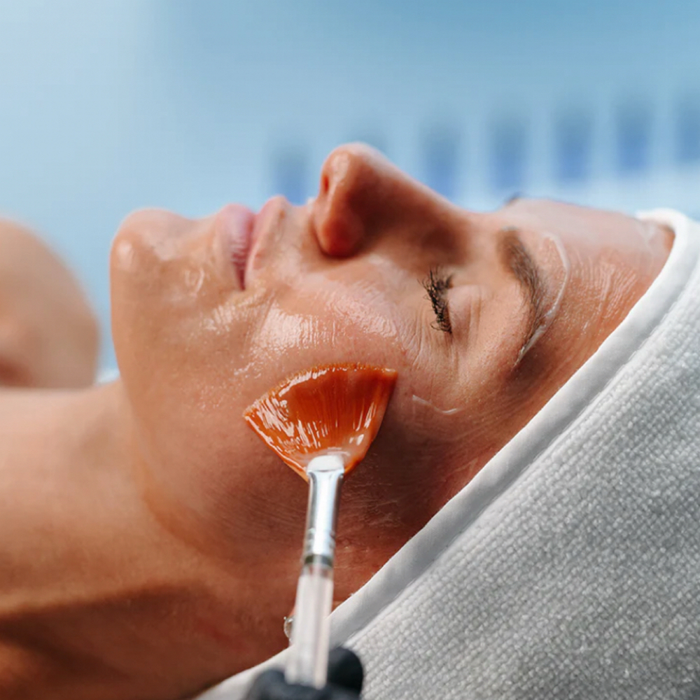SWiCH™ Chemical Peel Alternative at Lian Beauty Studio in Glendale, CO