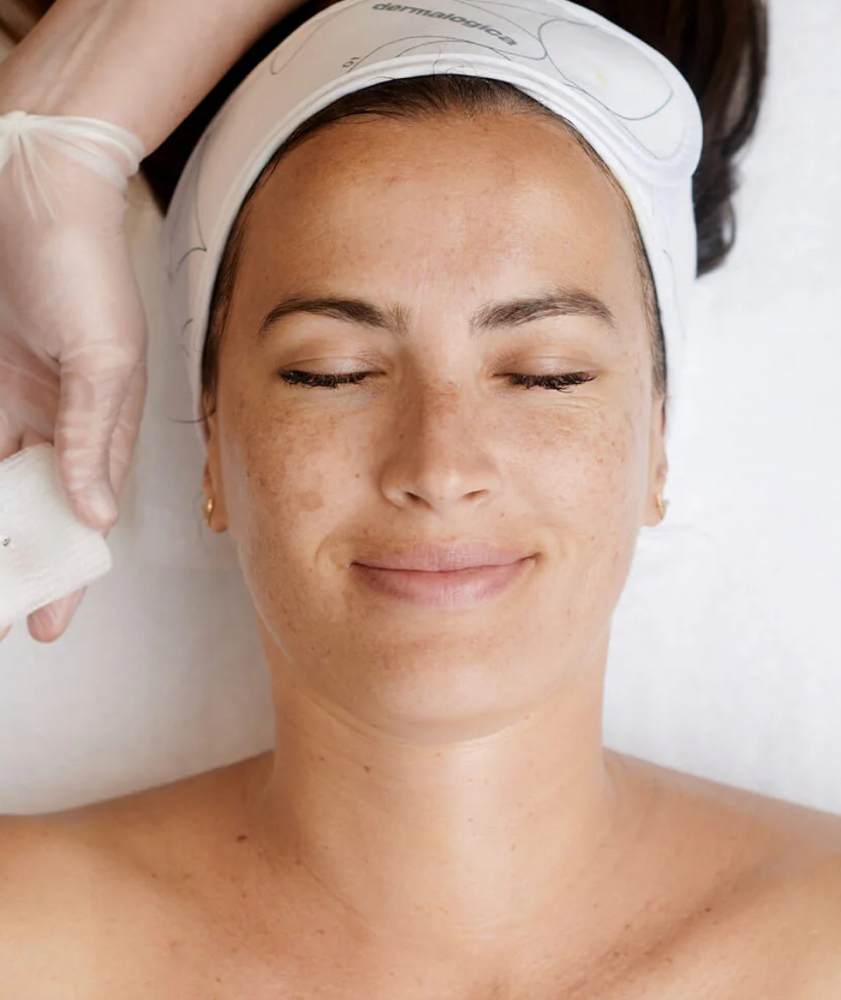 Melanopro Peel