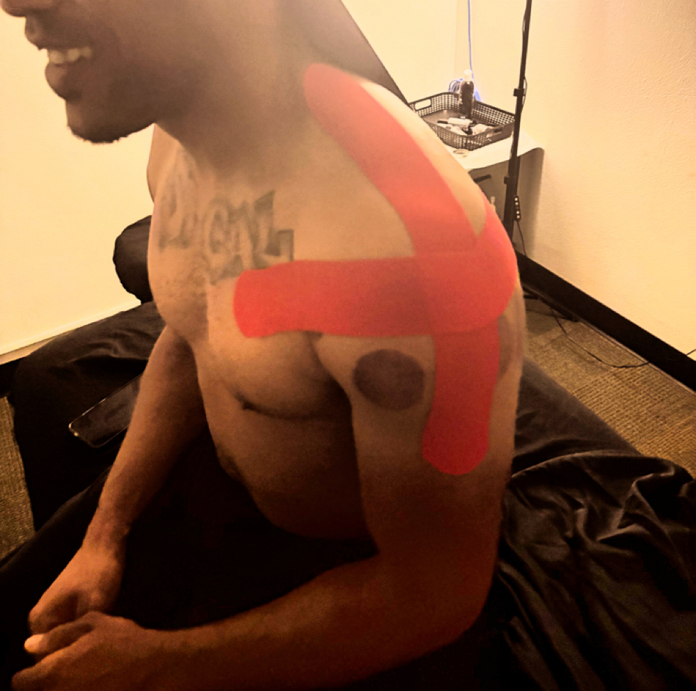 KT Tape Application at Right Therepy in Redlands, CA