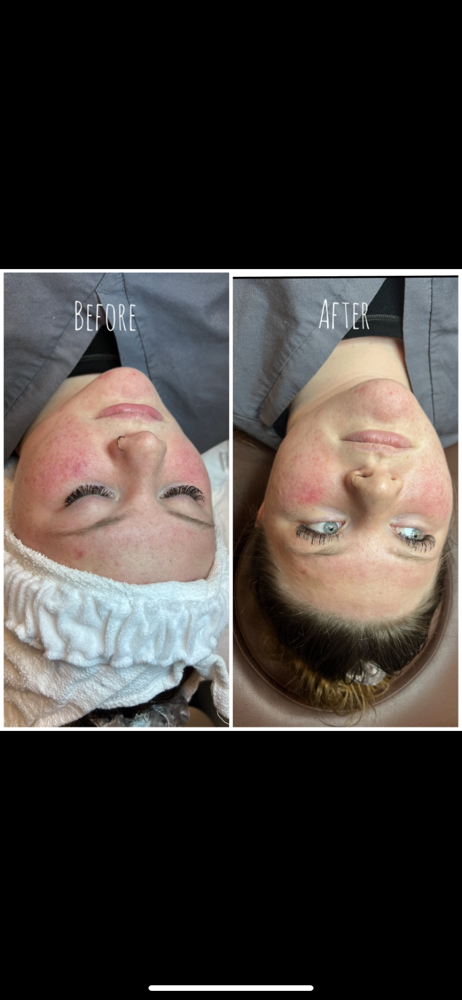 Customized Facial