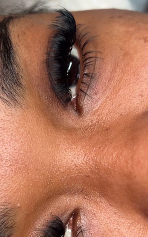 Volume Fill ( 2 Weeks) at Inalas_esthetique in Uniondale, NY