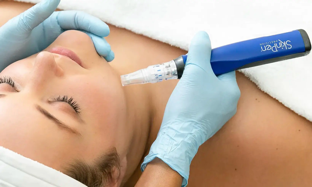 Growth Factor Microneedling