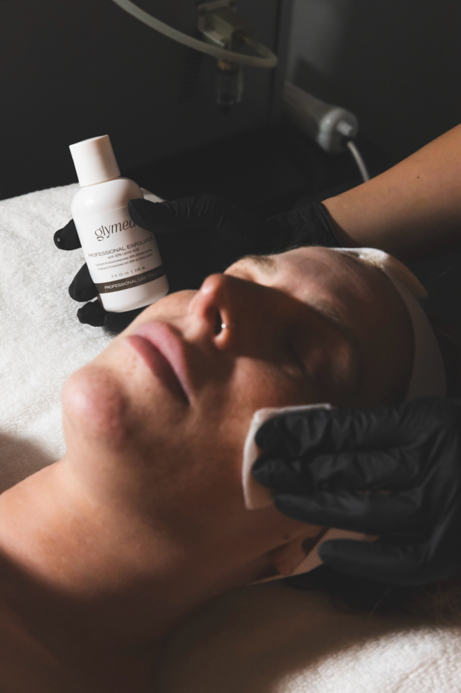 The MC Chemical Peel PACKAGE