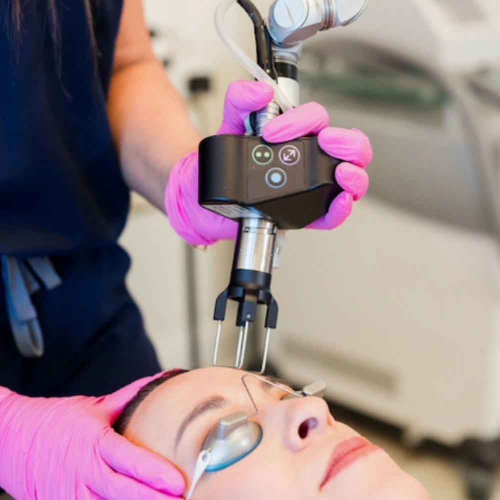 CO2 Skin Rejuvenation at Gingerbeam Spa & Wellness in Salina, KS
