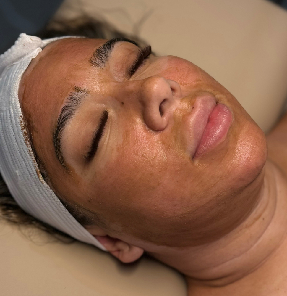 Enzyme Peel Facial