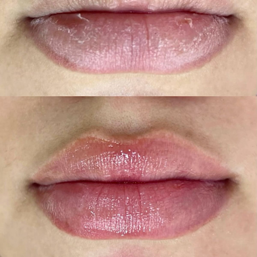 Lip Treatment add on at Altar Beauty Co. by Yury in Payette, ID
