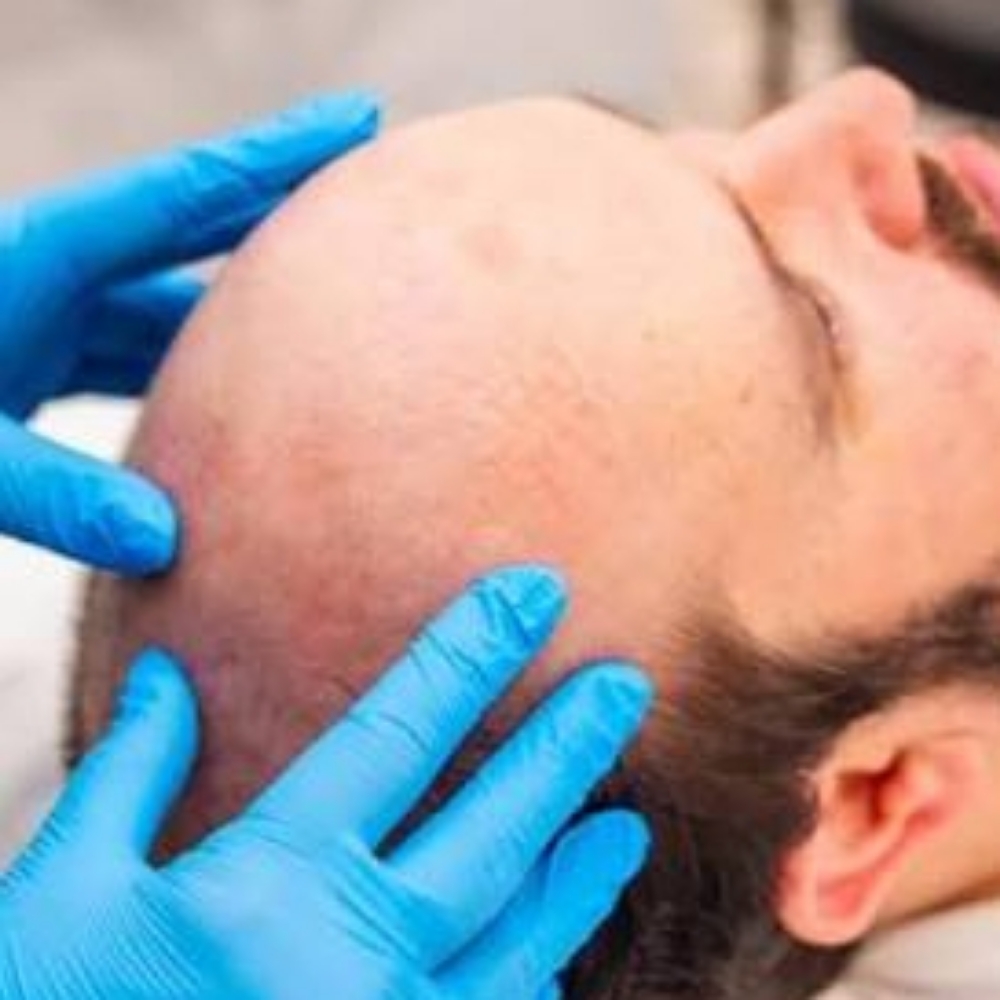 The Scalp Renewal at The UnSpa | Skin Renewal Studio in Chandler, AZ