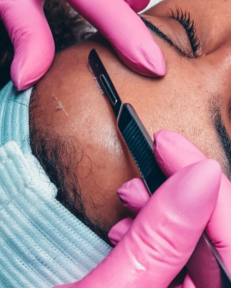 Deep Exfoliation + Dermaplane