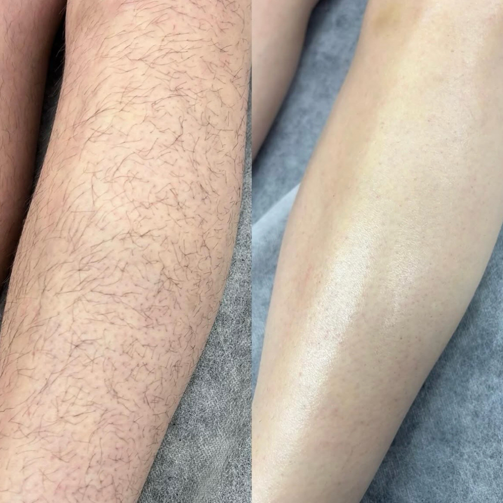 Half Leg Wax (Knee Down) at Beautyybydani in Red Bluff, CA