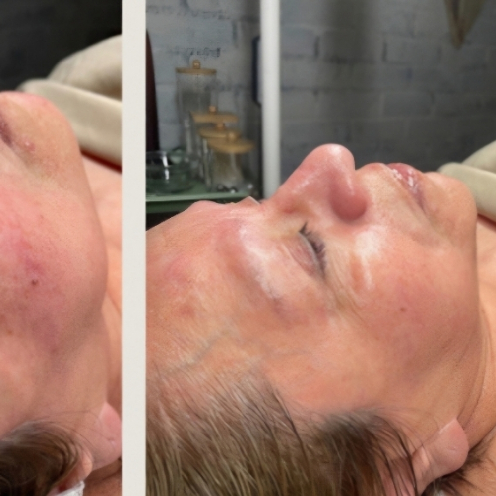 Age Gracefully Scultpting Treatment