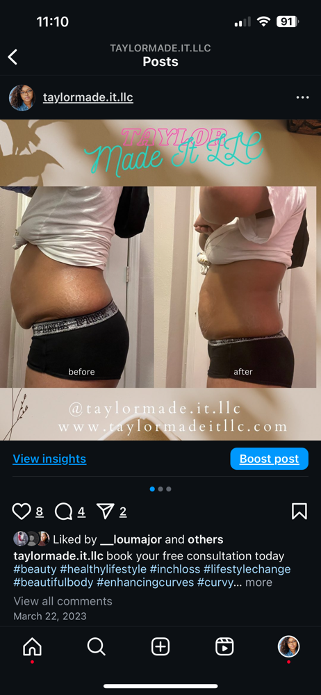 Lipo 360