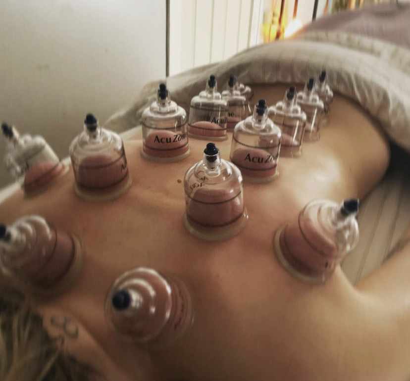 Cupping 90 Minutes