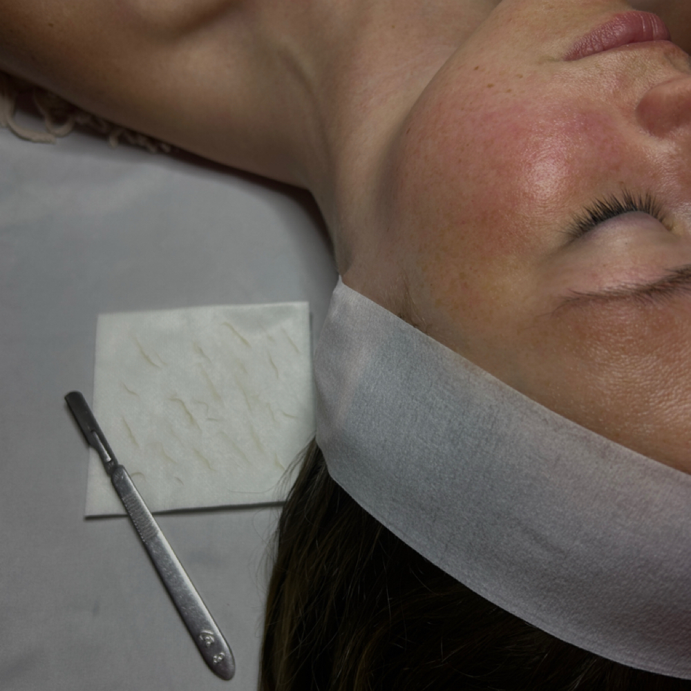 Derma-planing at Esthetics With Skylar in Sylvester, GA