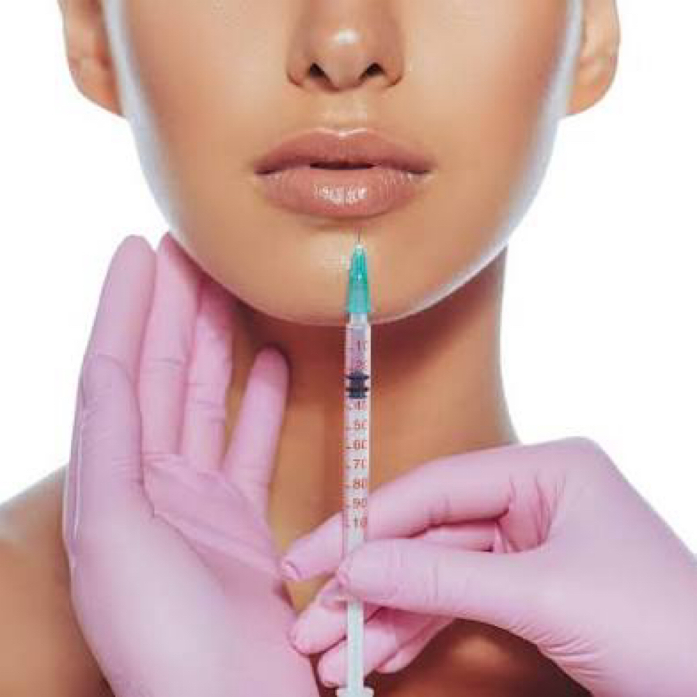 Filler (Lip plump) 0.75ml at Zen Beauty in McAllen, TX