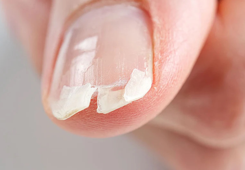 Nail Repair at ERA Nail Studio in East Derry, NH