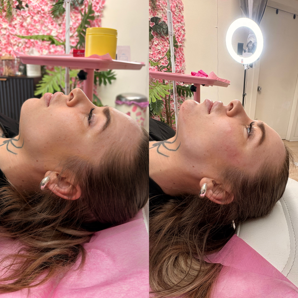 The Signature Balance 4 Ml at Balance.Bar.Aesthetics in Berkeley, CA