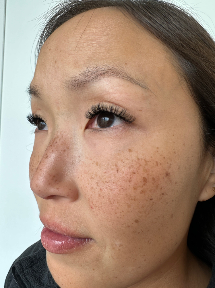 Hybrid Fill