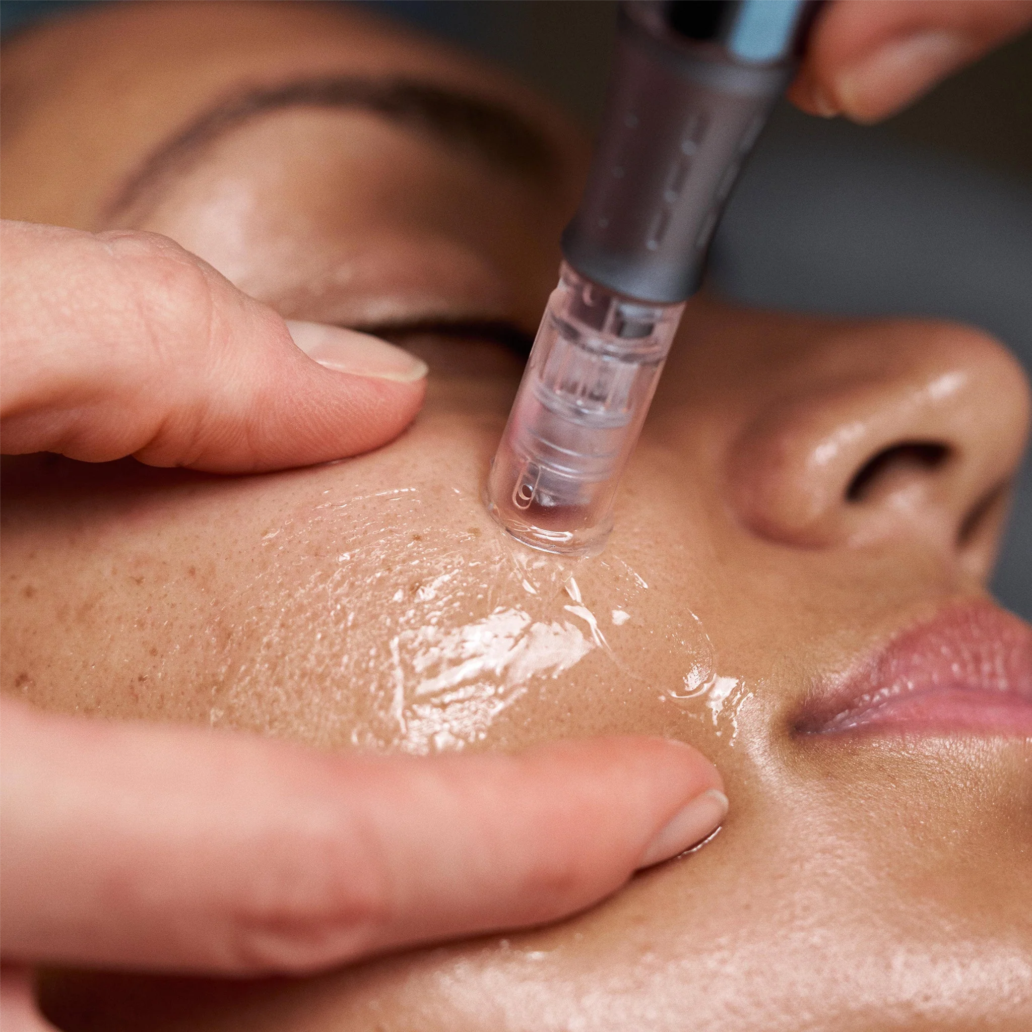 Advanced Facial at AZ Brows & Skin in Scottsdale, AZ