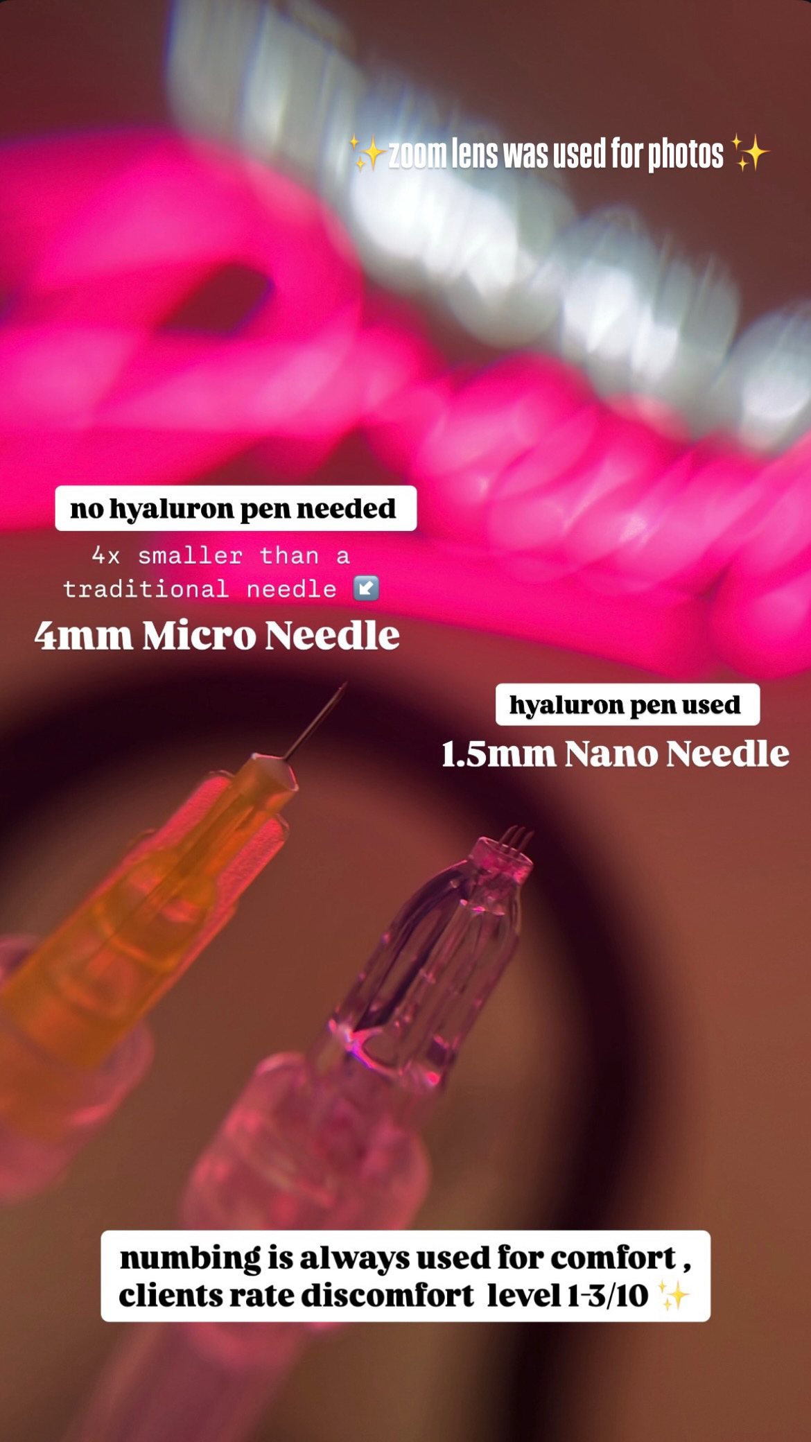 Micro Needle Lip Filler Training at J.LushAesthetix,llc in Jurupa Valley, CA