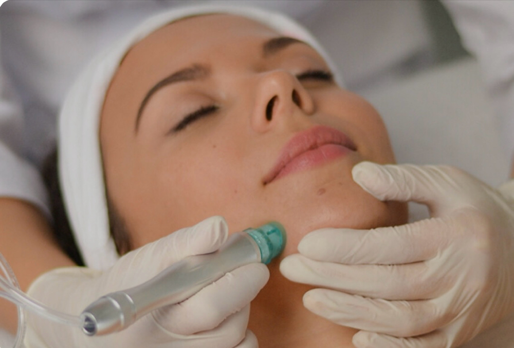 Hydrodermabrasion Facial