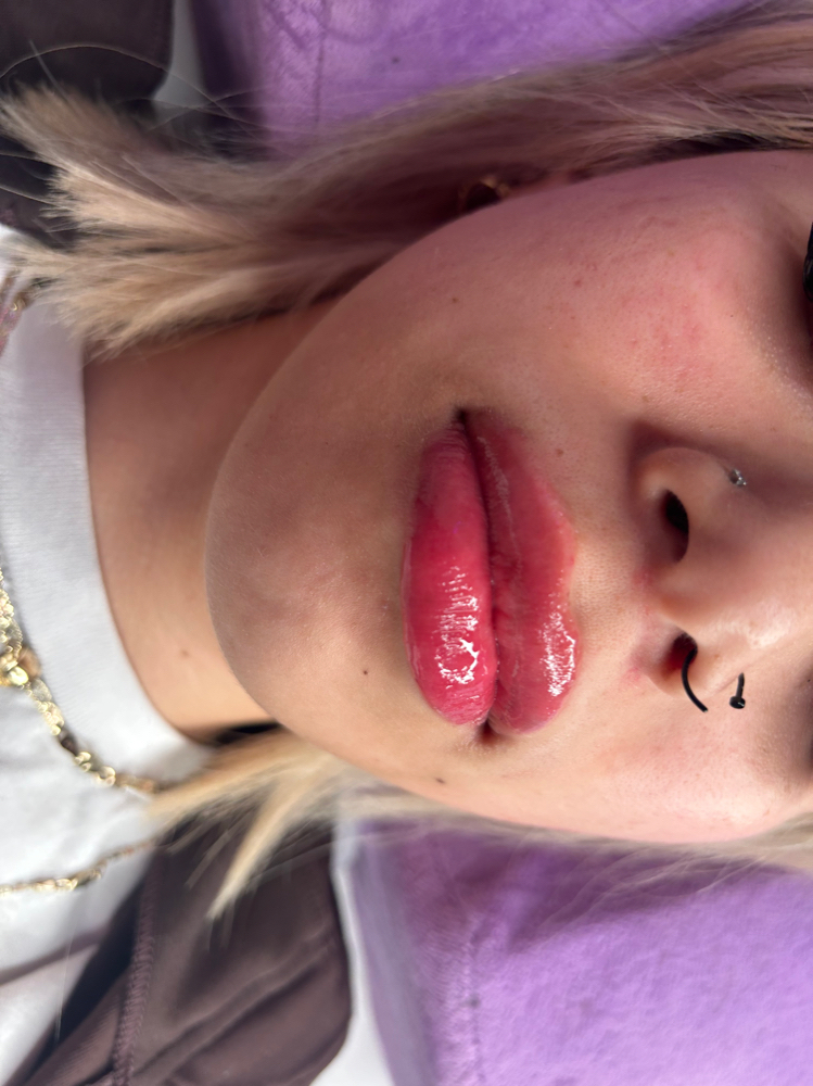 Plump Lips 1ml