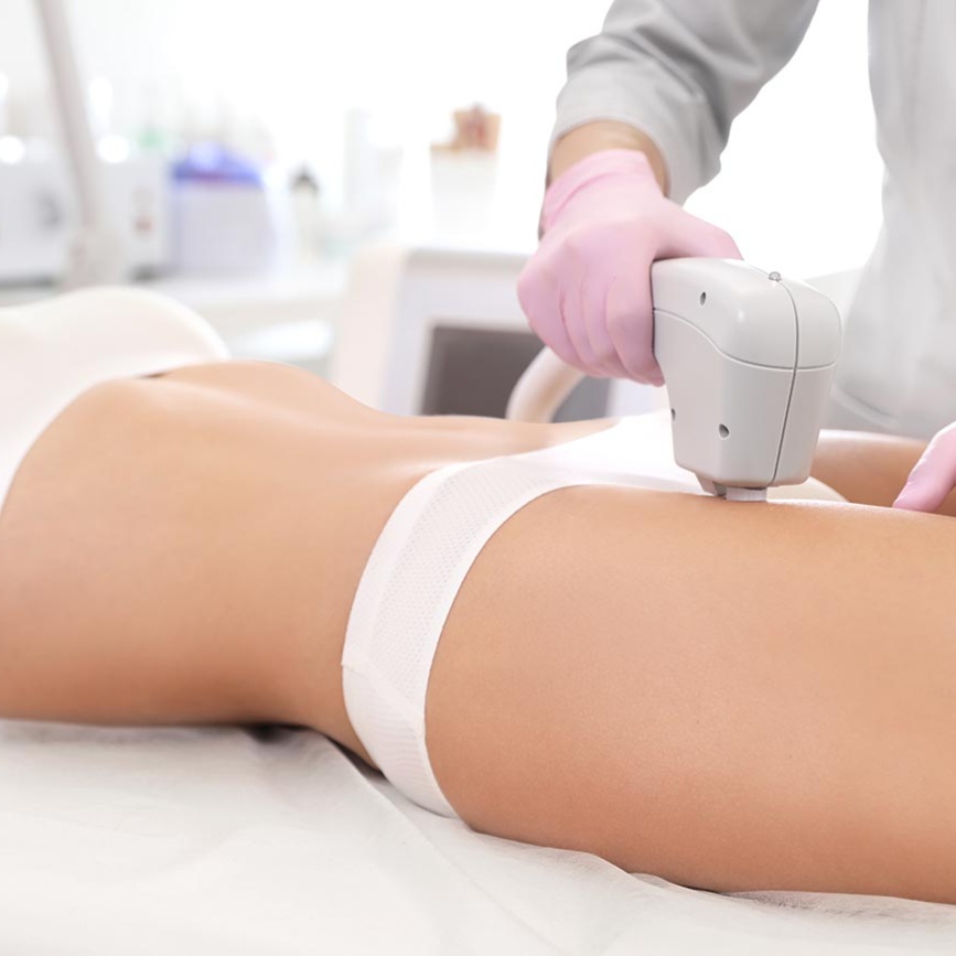 Full Body Laser Hair Removal at Body Care Spa in Baytown, TX
