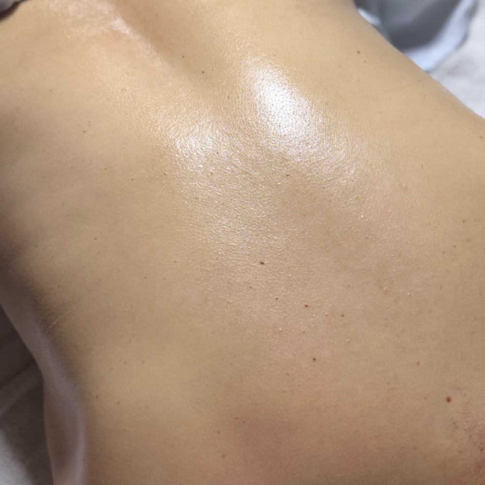 Red Carpet Ready Back Facial at Serene Skin byWansada in Matthews, NC