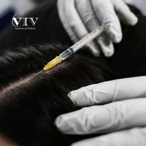 PRF Hair Restoration at Viv Aesthetics & Wellness in San Antonio, TX