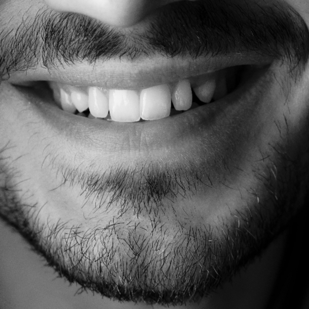 Teeth Whitening Maintenance at The Neon Door in Tucson, AZ