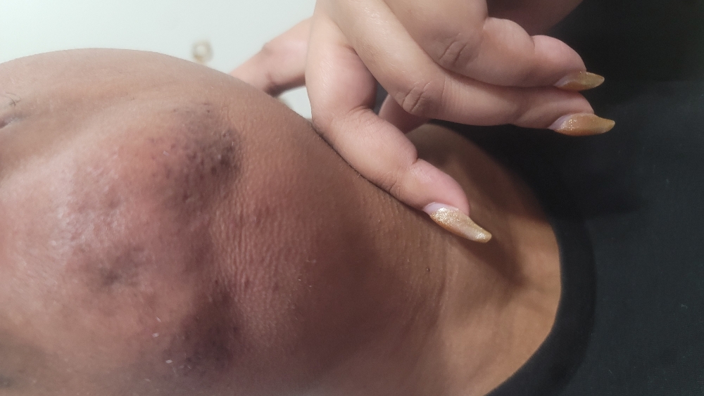 Chin wax at Haus Of Purity in Flint, MI