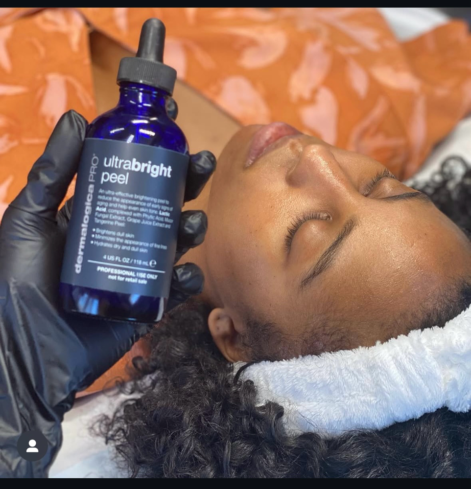 Chemical Peel