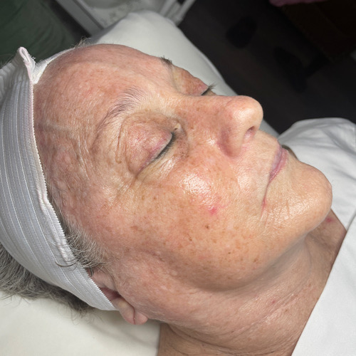 Oxygen RX Facial