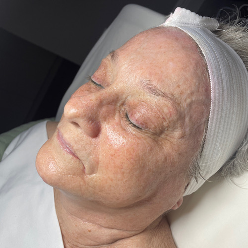 Oxygen RX Facial