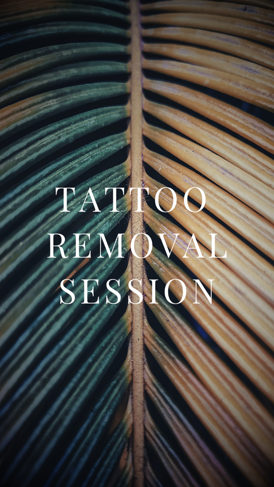 Saline Tattoo Removal at STERLING INK & GLO in El Cajon, CA