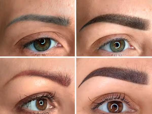 Brow Correction