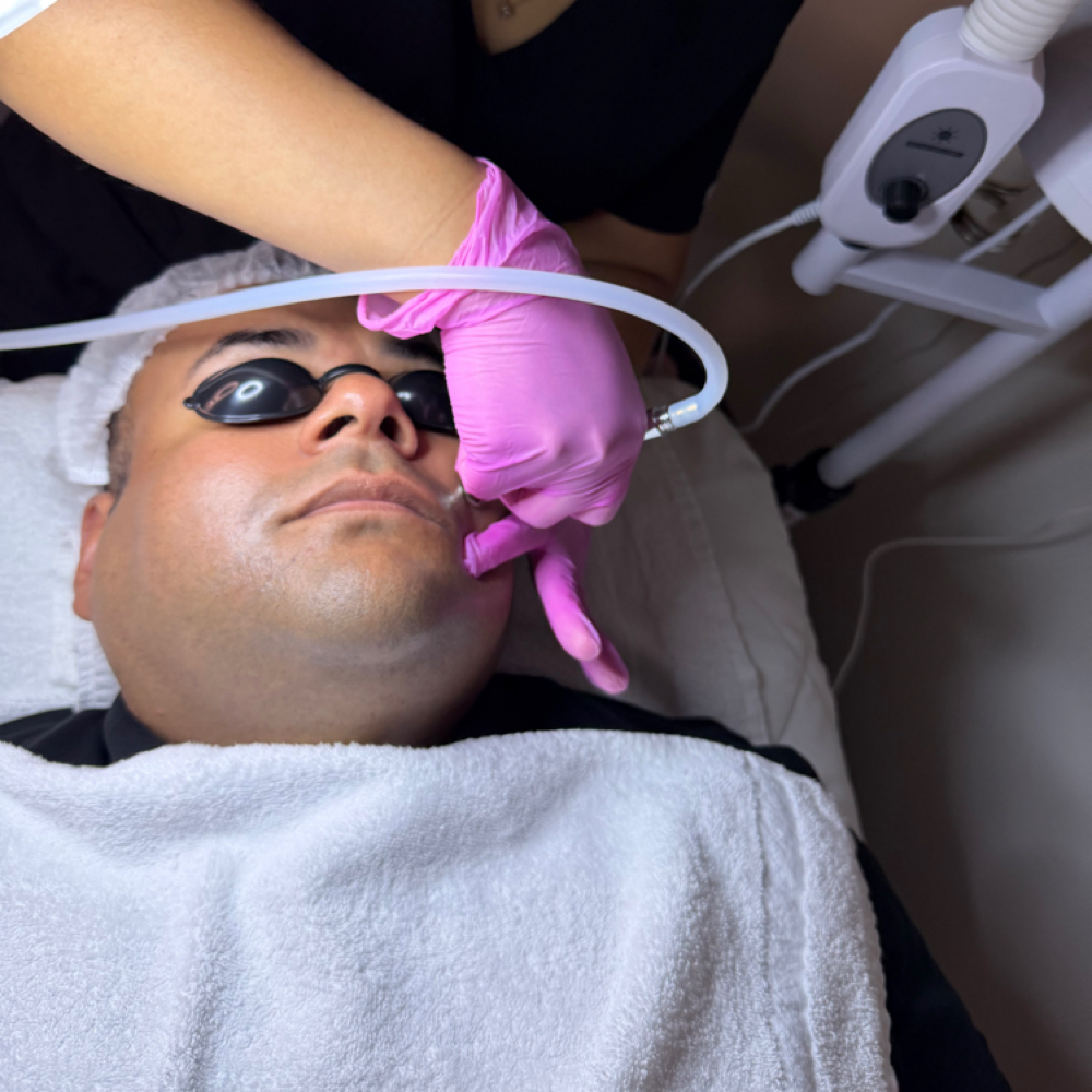 Microdermabrasion + High Frequency at Heavenly Spa in Clayton, NC