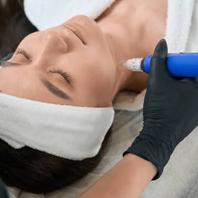 SkinPen Microneedling Neck Glo