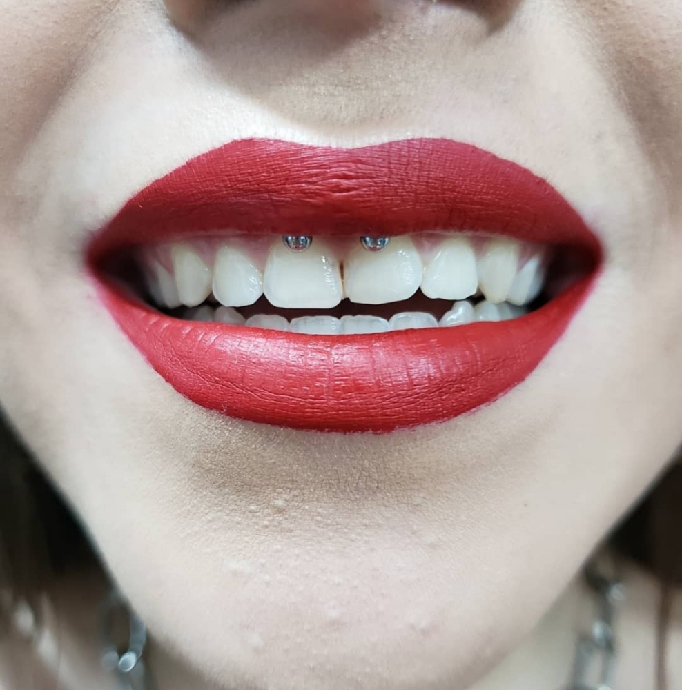Smiley Piercing