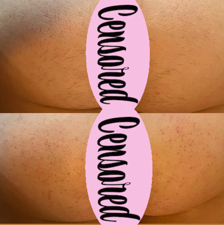 Womens Full Butt