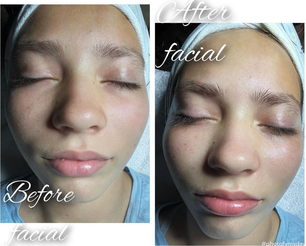 The Sweetheart Facial 12 And Under