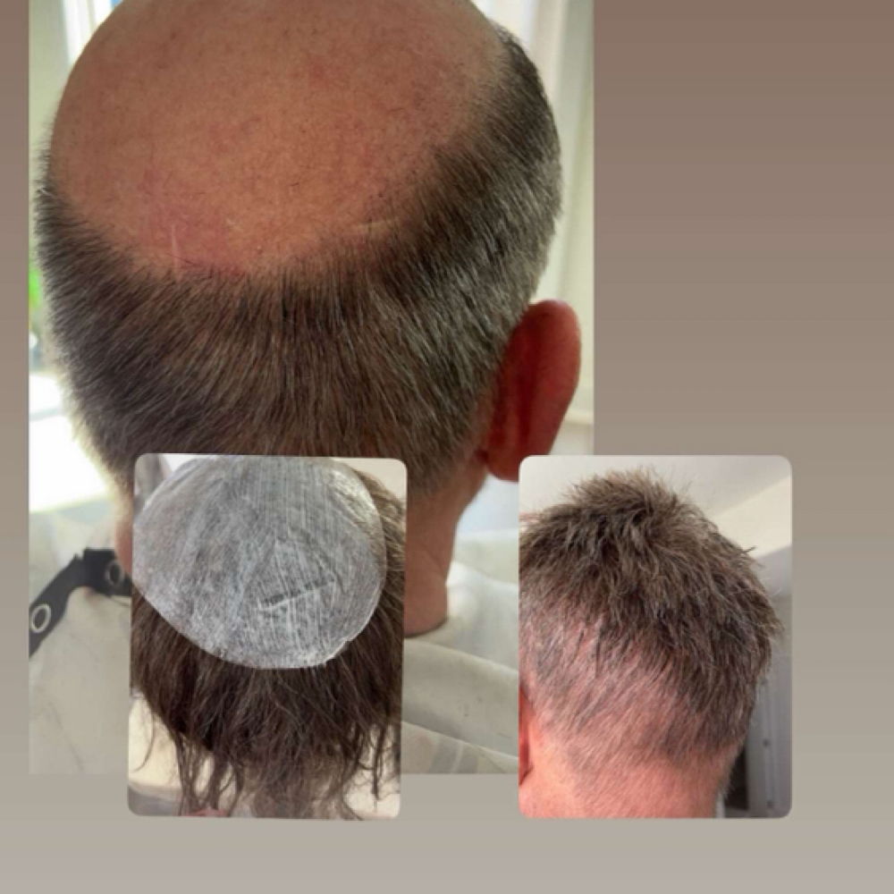 New Hair System & Cut In at Allure ICT in Wichita, KS