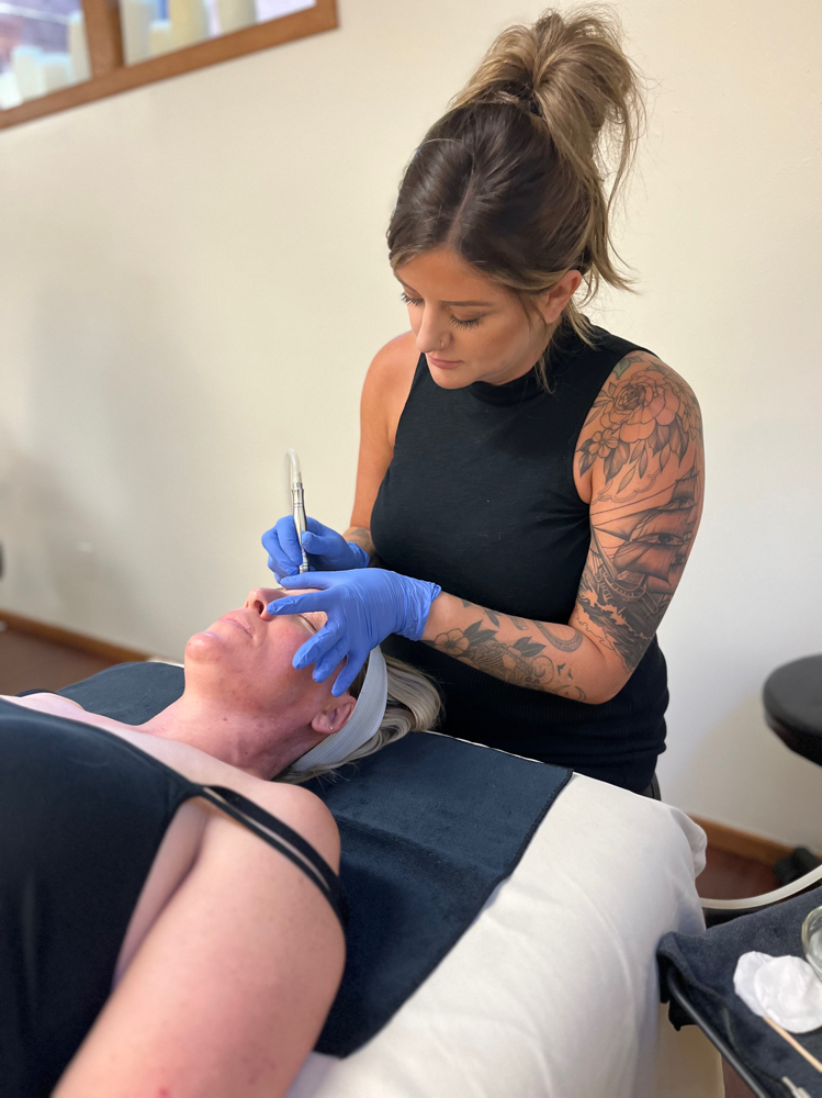 Microdermabrasion Facial